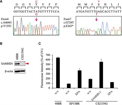 Aicardi–Goutières syndrome with SAMHD1 deficiency can be diagnosed by unscheduled DNA synthesis test